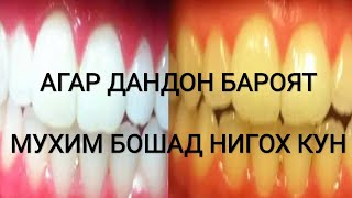 ОСОНТАРИН РОХИ ТОЗА ВА САФЕДКУНИИ ДАНДОН. хороший рецепт для зубы очень интересно