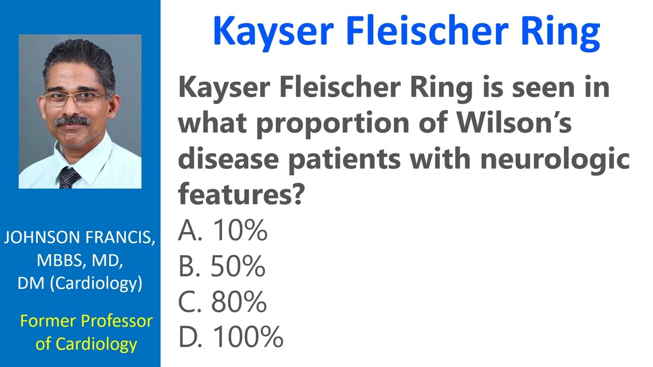 Anterior segment optical coherence tomography (AS‐OCT) as a new method of  detecting copper deposits forming the Kayser–Fleischer ring in patients  with Wilson disease - Broniek‐Kowalik - 2019 - Acta Ophthalmologica - Wiley