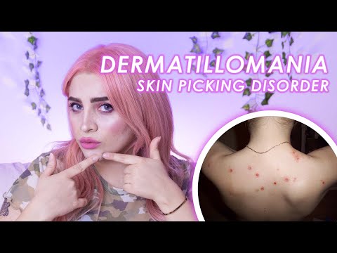 Video: Picking Del Cuoio Capelluto: è Dermatillomania O DOC? E Consigli Su Come Fermarsi