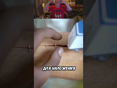 Зашитие руки человека🤨 (@zackdfilms)