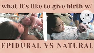 Giving birth with epidural vs natural | TMI details on labor, delivery, and postpartum