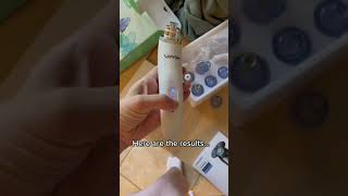 Celebrity My husband tried a pore vacuum FAIL… #shorts Wealth