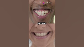 What Do Blind People See When They Close Their Eyes?