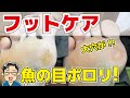 長年の魚の目（ウオノメ）取れたら大穴が！