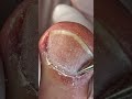 Cleaning up the cuticle area and removing dead skin