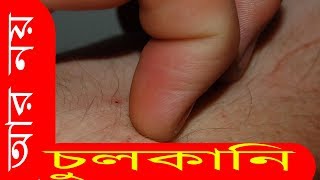 চুলকানি হলে কি করবেন জেনে নিন। screenshot 1