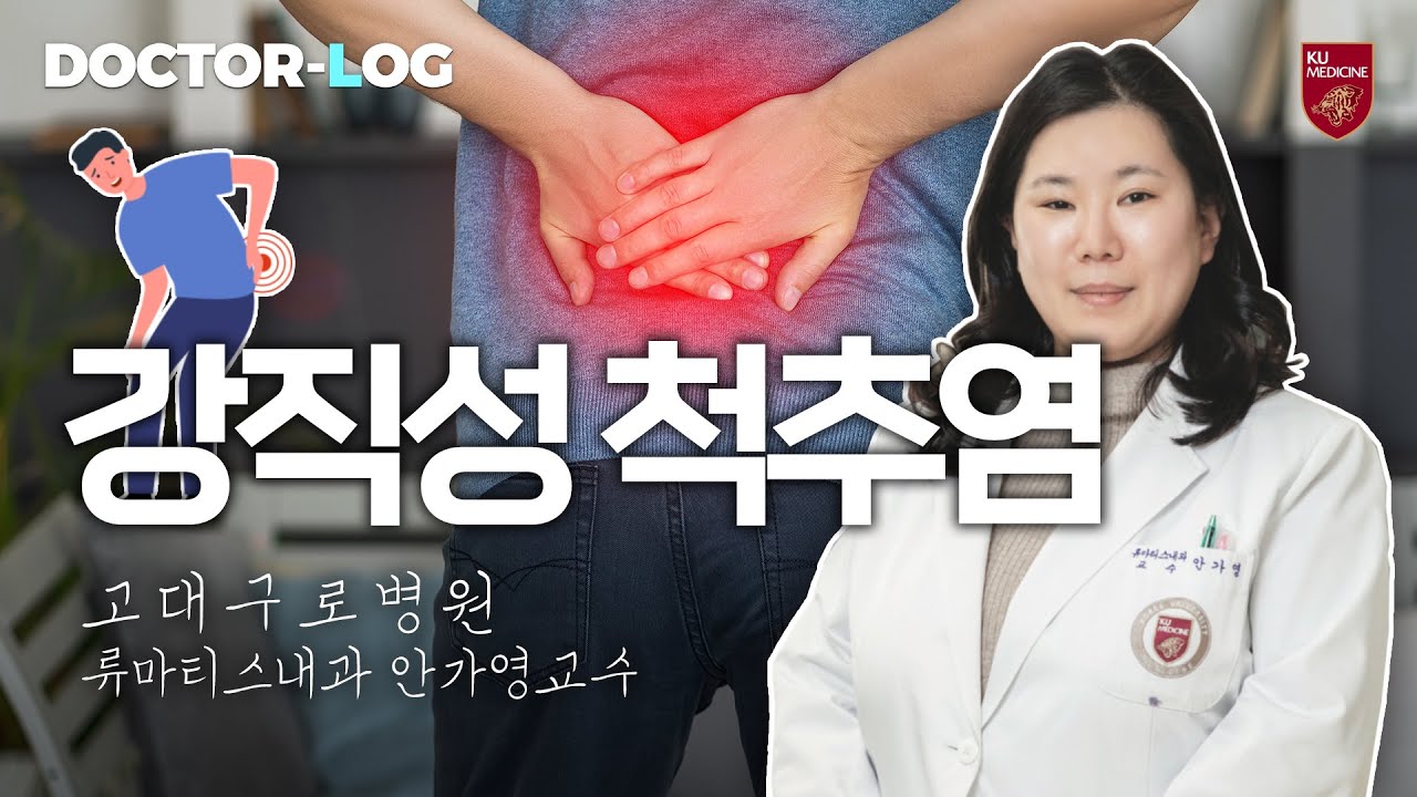[Dr.log] 남녀비가 9:1 ?? 강직성 척추염이 젊은 남성에서 특히 많은 이유❗️🤔