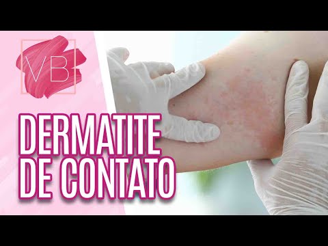 Vídeo: Como tratar a dermatite de contato: 15 etapas (com fotos)