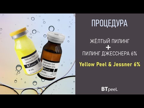 Процедура Жёлтый пилинг + Пилинг Джесснера 6