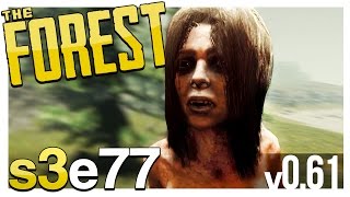SHE'S GOT THAT RACHEL FROM FRIENDS HAIRCUT | The Forest Gameplay S3E77 (Update v0.61)