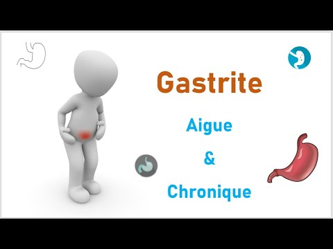 Vidéo: Différence Entre La Gastrite Aiguë Et Chronique