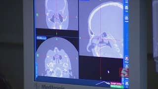 Chiari Malformation: Not Just A Headache