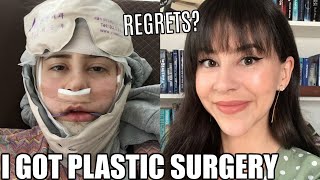 I GOT PLASTIC SURGERY IN KOREA || Double Jaw Surgery One Year Update