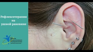 Рефлексотерапия на ушной раковине (аурикулотерапия)