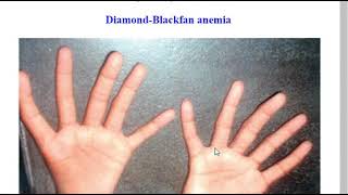 Reading ZANKI (Anki for the USMLE)
