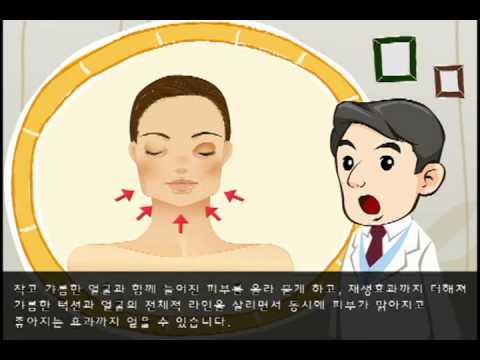 V라인 살리는 PDO리프팅이란(TR라인&울트라V리프트)?