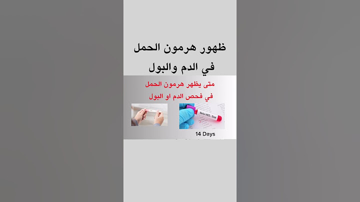 تحليل الحمل في الدم وتحليل الحمل في البول | هرمون الحمل