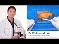 Goldfish surgery of damaged popped eye by fish veterinarian Dr Loh