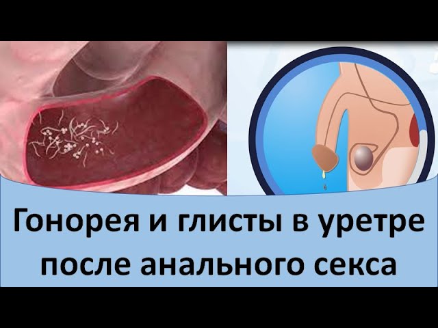 Откровенно о деликатном. Интервью от Эс Класс Клиник Ульяновск Откровенно о деликатном. Интервью от Эс Класс Клиник Ульяновск