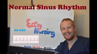 Normal Sinus Rhythm - NCLEX Review