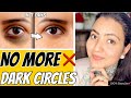 Remove DARK CIRCLES Permanently In 7 Days | 100% Results