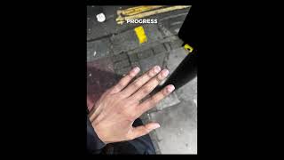 Dark Knuckle Transformation | Real Client Results #shorts