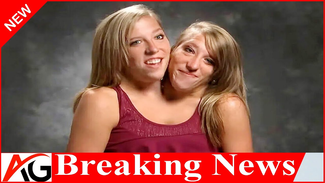 Conjoined Twins Abby And Brittany Hensel Spark Buzz After Being Seen ...