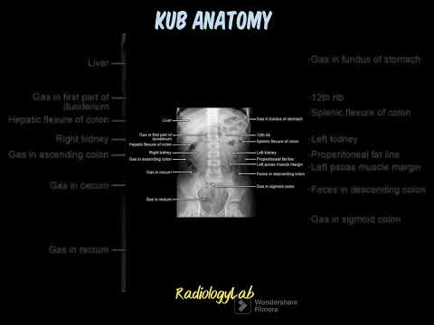 KUB Anatomy @radiologylab  X Ray