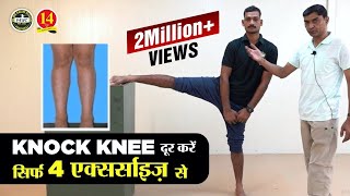 What is Knock Knee? How to solve Knock Knee problem for Medical in Army, Air Force and Navy?