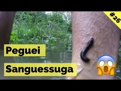 The leech