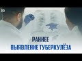 Туберкулез - причины заболевания