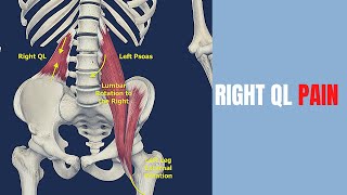 Quadratus Lumborum and Left Psoas Stretches for Pelvic Tilts