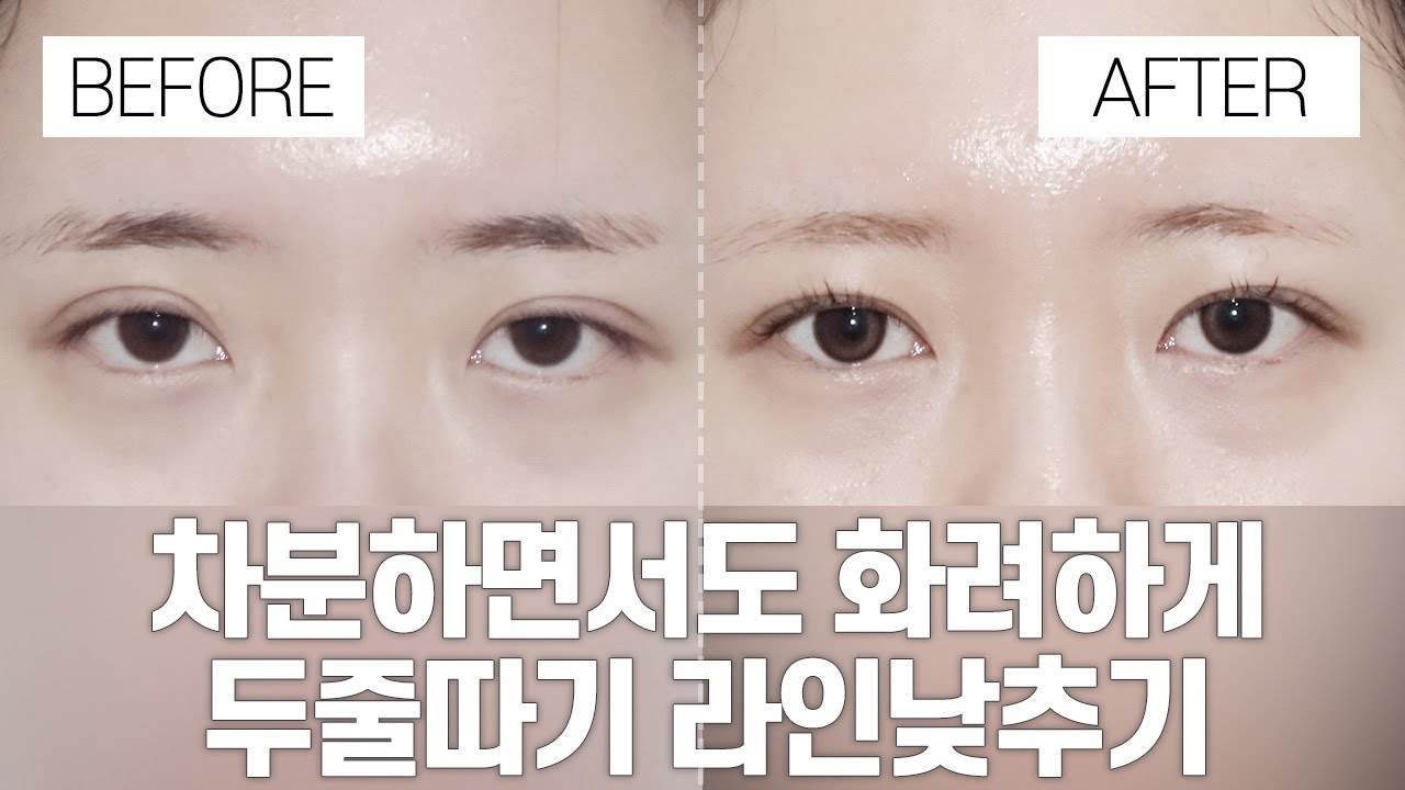 [Ганнам Соён гоо сайхны мэс засал] Нүдний гоо сайхны мэс заслын өмнө ба хойно | Тайван мөртлөө тансаг, давхар зовхины шугам үүсгэх, шугамыг намсгах