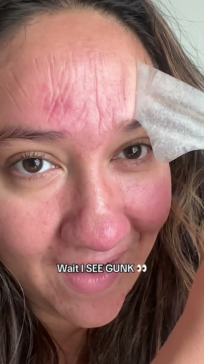 Does Hero’s Mighty Patch™ Forehead patch REALLY WORK??