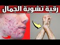 رقية قوية لفك حسد الجمال وإزالة سحر تشويه الوجه وجلب القبول والنور الامارات السعودية قطر البحرين