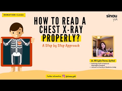 Donation Class : How to Read A Chest XRay Properly