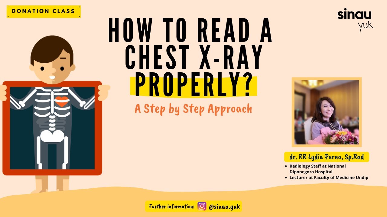 Donation Class How to Read A Chest XRay Properly YouTube