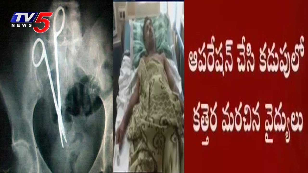 కడుపులో కత్తెర..! | Doctor Left Scissors In Patient Stomach | Nellore | TV5 News