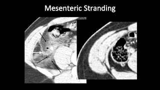 Celebrity EMRADS Appendicitis Wealth