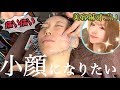 痛くとも小顔になりたい!美容鍼を旦那さんに撮影してもらいました!