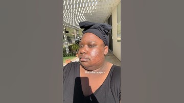 Chin Lipo & Skin Tightening was the best decision ever for me❤️