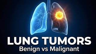 Lung Tumors Explained in Detail | Benign vs Malignant | Types of Lung Cancer | Pathology