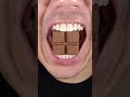 ASMR Ritter SPORT Chocolate 😳