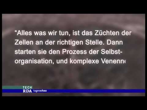 German News, Vascularised Tissue