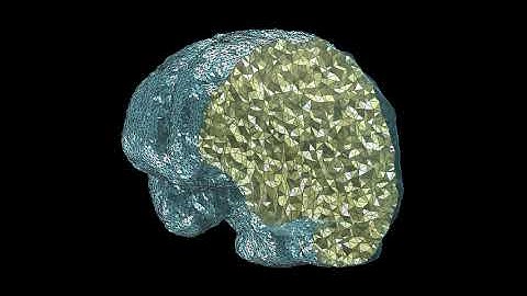 Optimal Mass Transportation Path between Brains