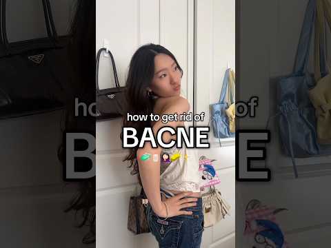 Day 5 Of Teaching U Things Ur Mom Never Taught U HOW TO GET RID OF BACNE Acnetips Bodycare