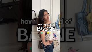 Day 5 Of Teaching U Things Ur Mom Never Taught U.. How To Get Rid Of Bacne