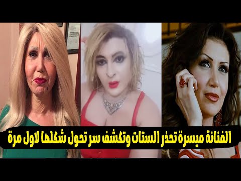 حقنت دهون فى وشي فتحولت لدود فى كل جسمي الفنانة ميسرة تكشف سبب تحول شكلها لشئ مخيف