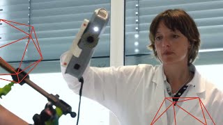 Using Artec 3D Scanners for Orthotics and Prosthetics