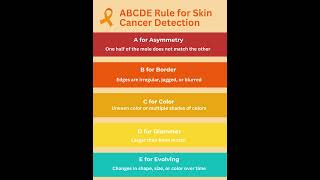 ABCDE Rule